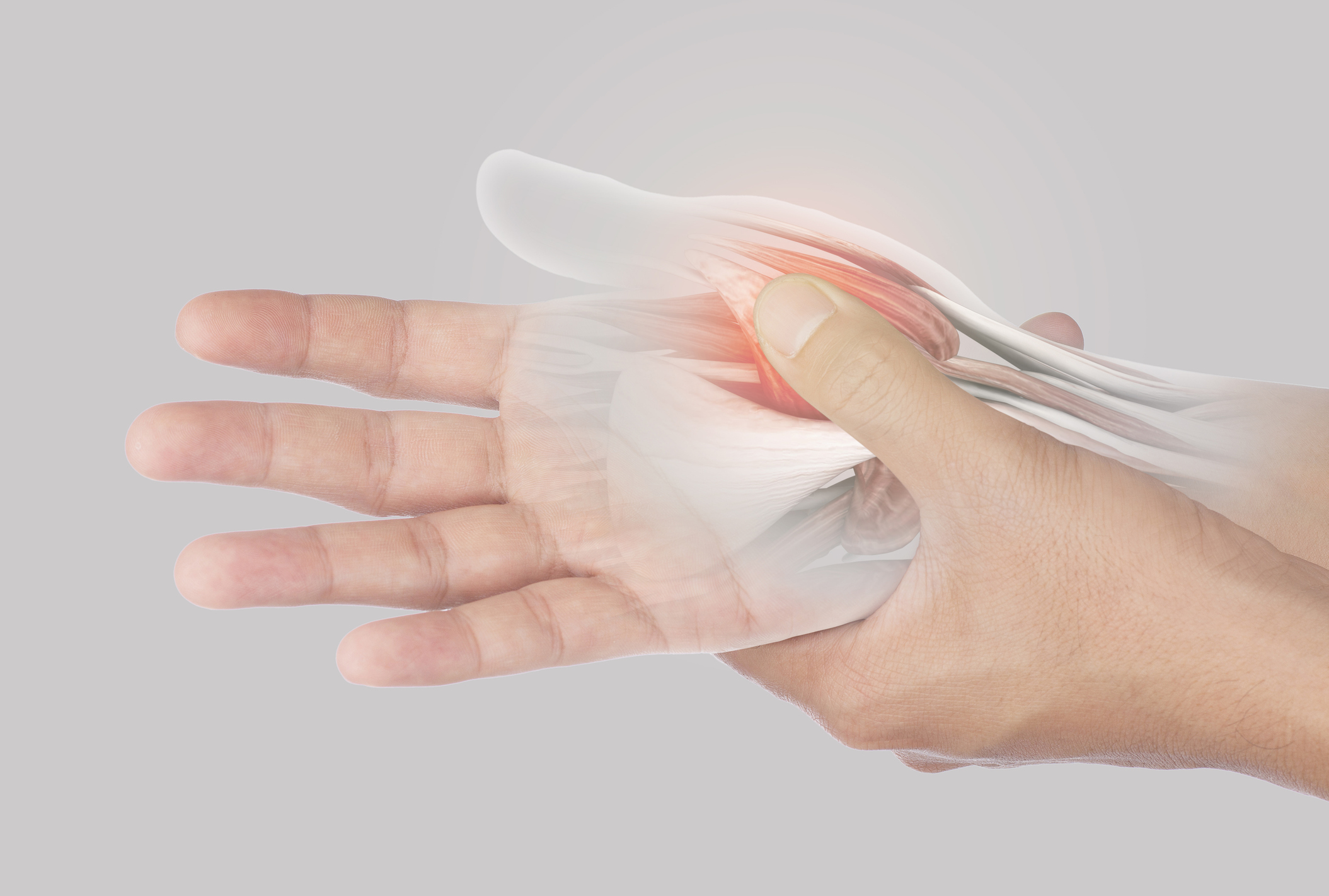Tendon Repair